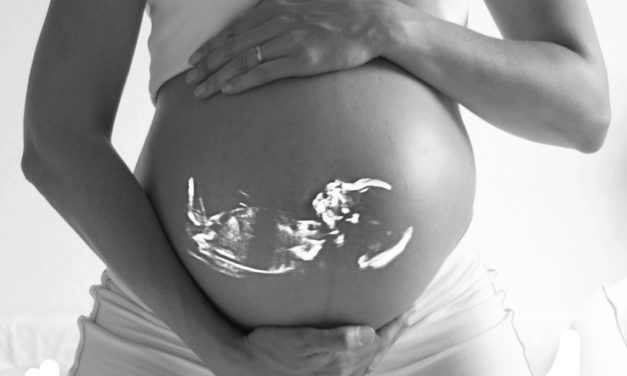 Všetko, čo potrebujete vedieť o ultrazvuku v tehotenstve